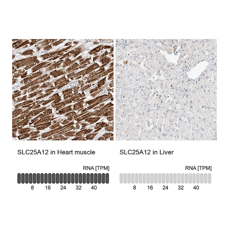 Atlas Antibodies Anti-SLC25A12 Antibody