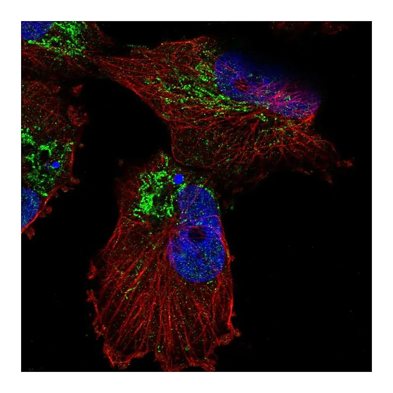Atlas Antibodies Anti-SLC25A14 Antibody