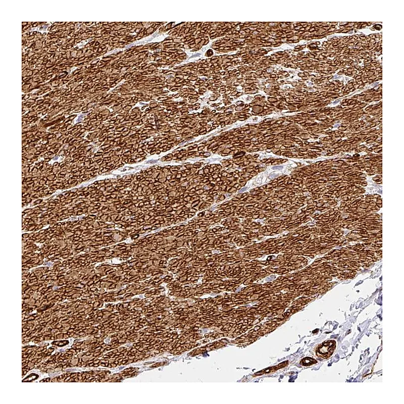 Atlas Antibodies Anti-SLC25A17 Antibody