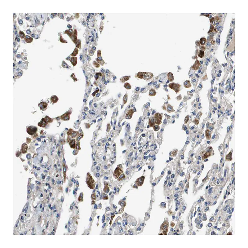 Atlas Antibodies Anti-SLC25A20 Antibody