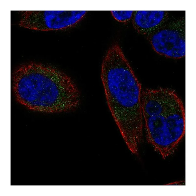 Atlas Antibodies Anti-SLC25A23 Antibody