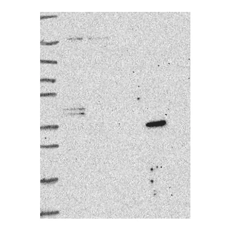 Atlas Antibodies Anti-SLC25A18 Antibody