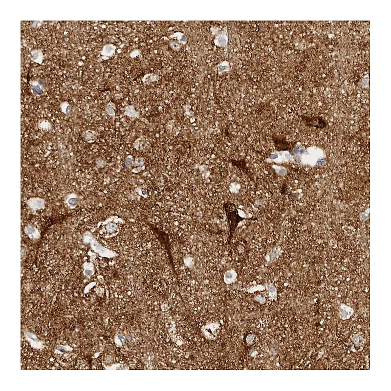 Atlas Antibodies Anti-SLC25A22 Antibody