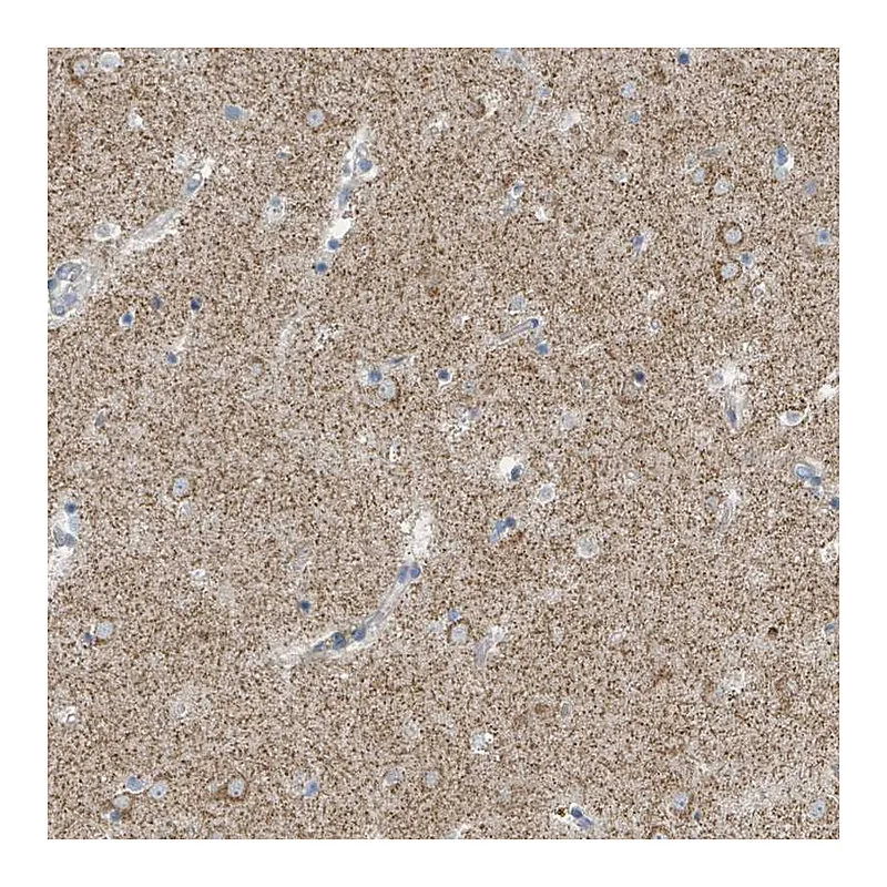 Atlas Antibodies Anti-SLC25A23 Antibody