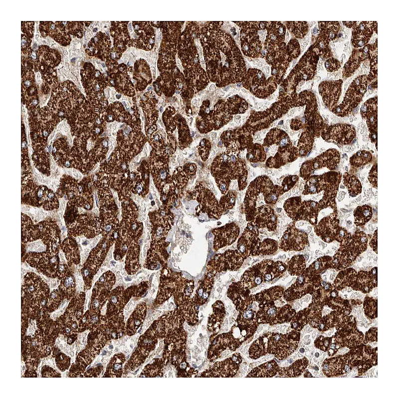 Atlas Antibodies Anti-SLC25A20 Antibody