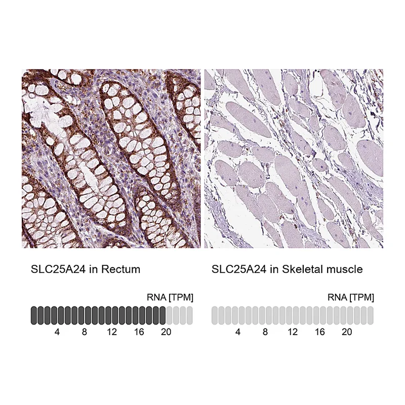 Atlas Antibodies Anti-SLC25A24 Antibody