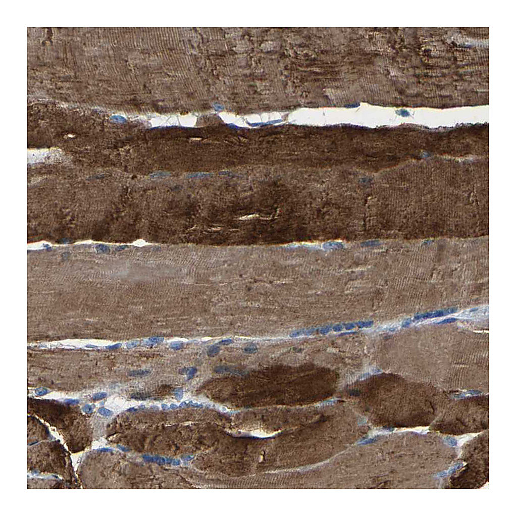 Atlas Antibodies Anti-SLC25A25 Antibody