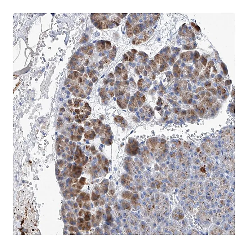 Atlas Antibodies Anti-SLC25A29 Antibody