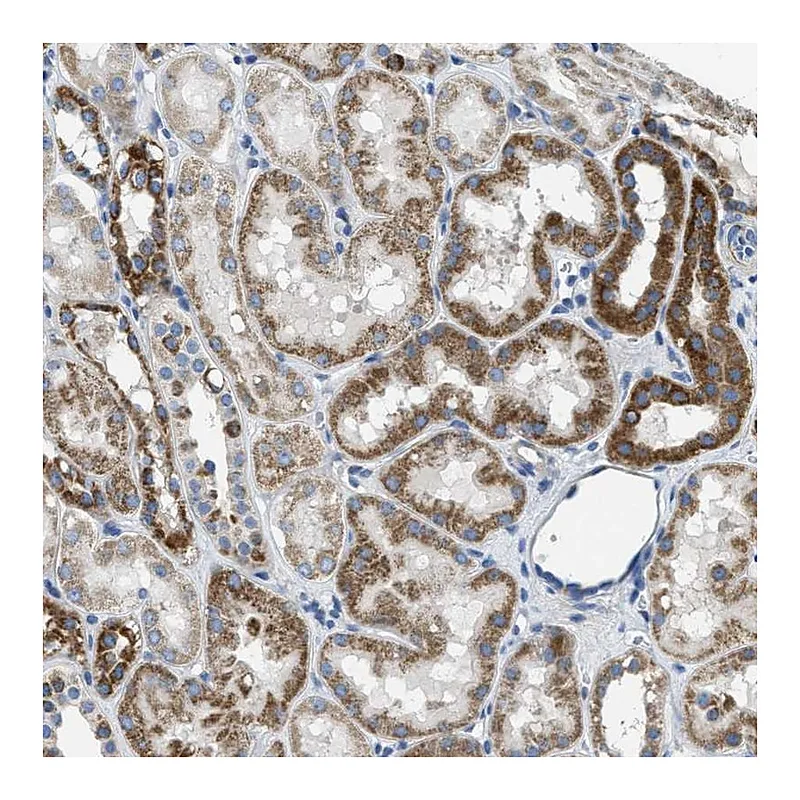 Atlas Antibodies Anti-SLC25A31 Antibody