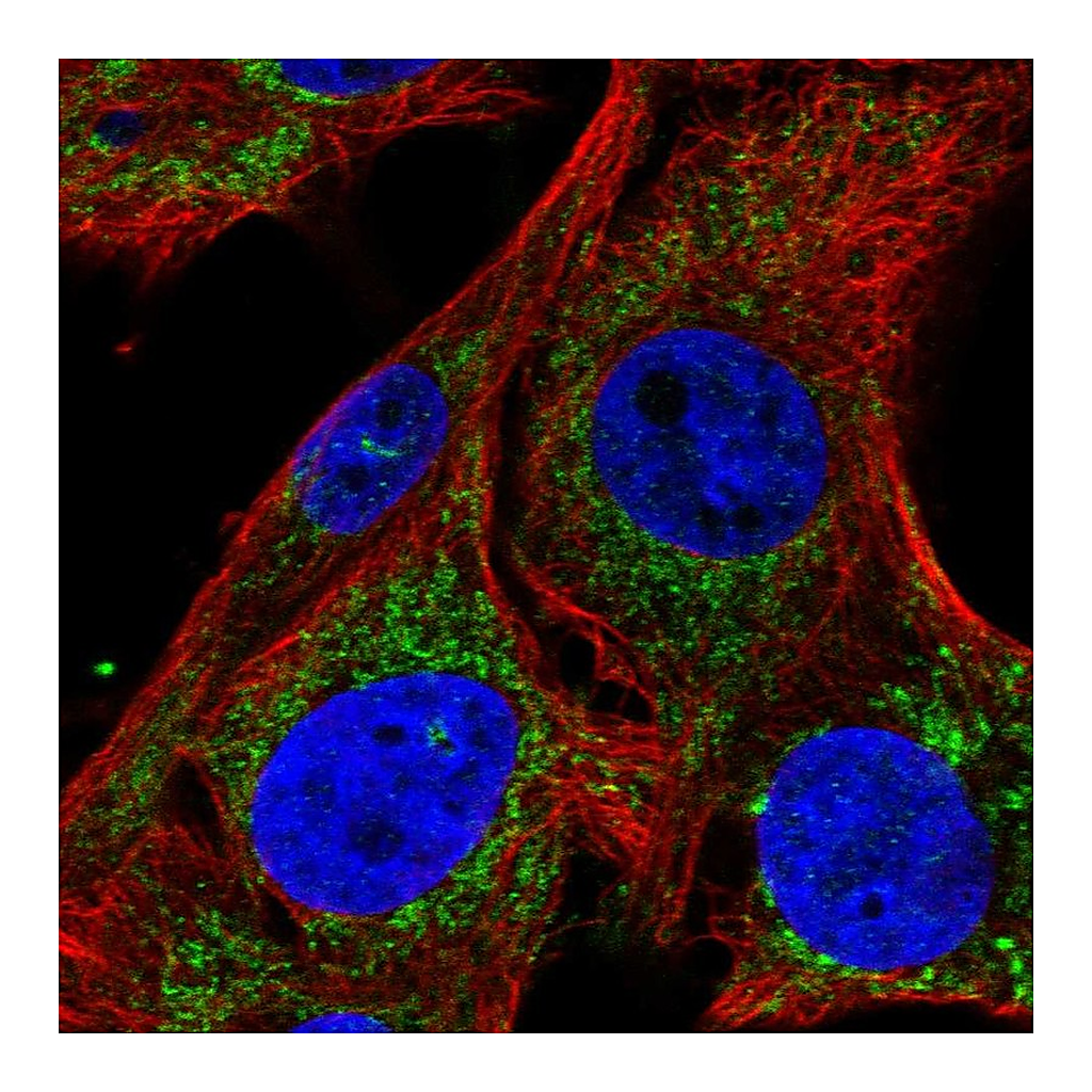 Atlas Antibodies Anti-SLC25A34 Antibody