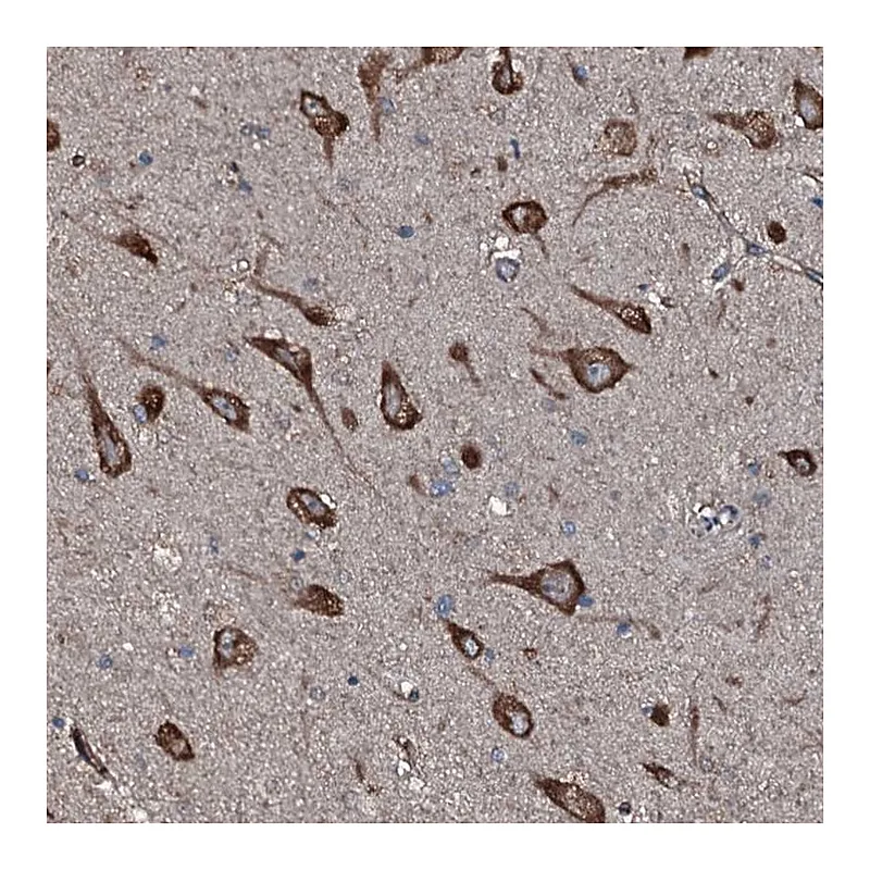 Atlas Antibodies Anti-SLC25A38 Antibody