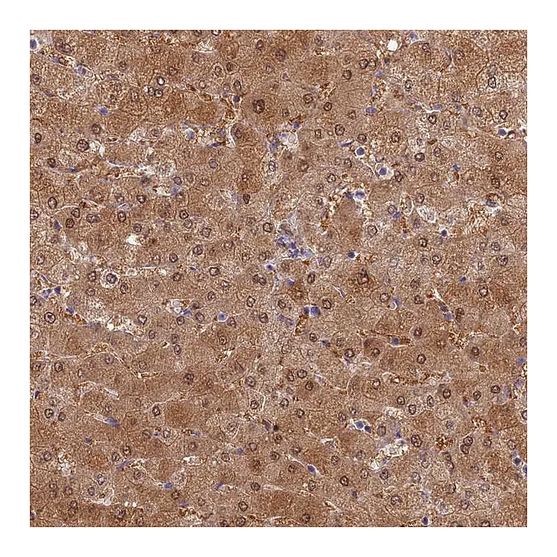 Atlas Antibodies Anti-SLC25A41 Antibody