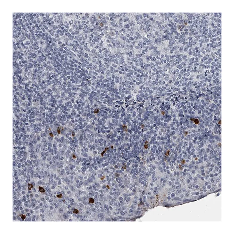 Atlas Antibodies Anti-SLC25A39 Antibody