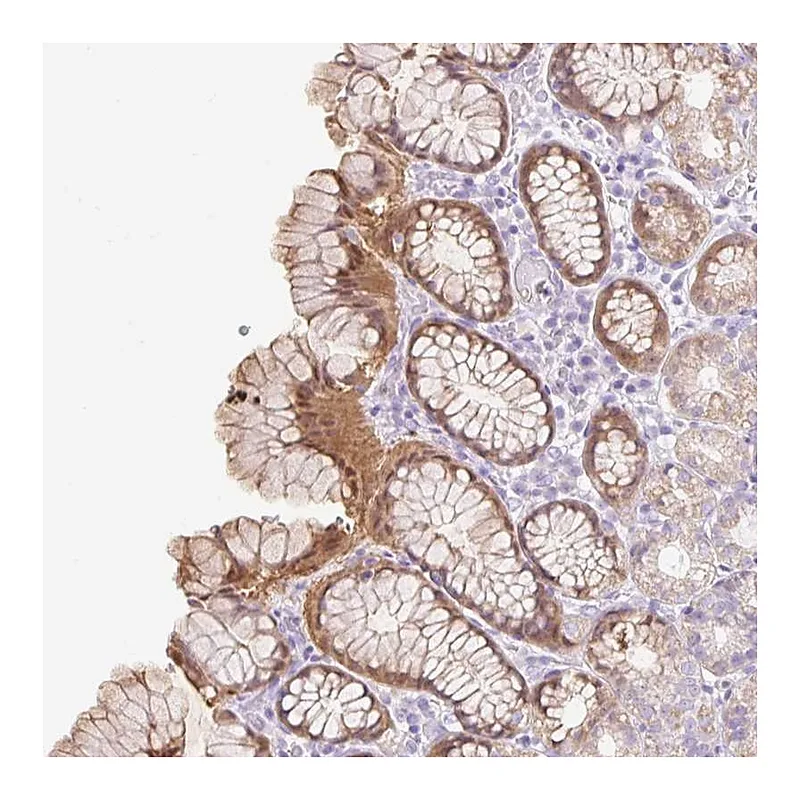 Atlas Antibodies Anti-SLC25A40 Antibody