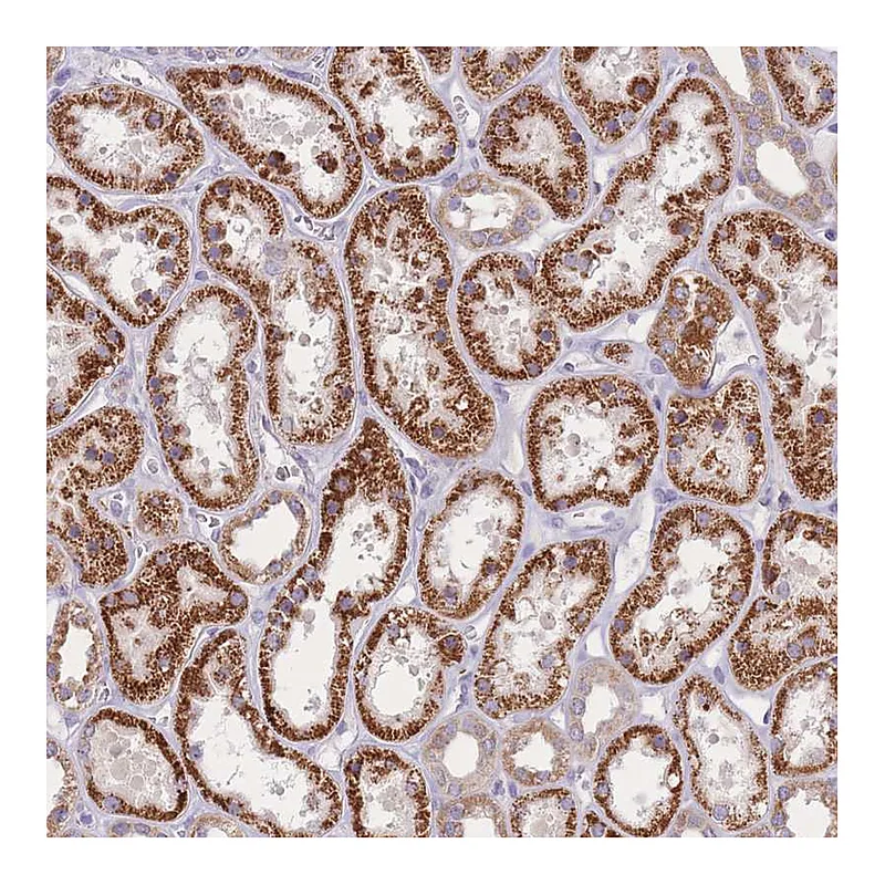 Atlas Antibodies Anti-SLC25A42 Antibody