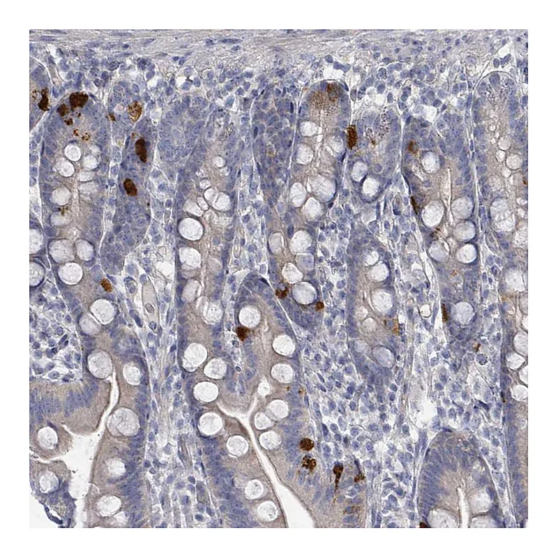 Atlas Antibodies Anti-SLC25A45 Antibody