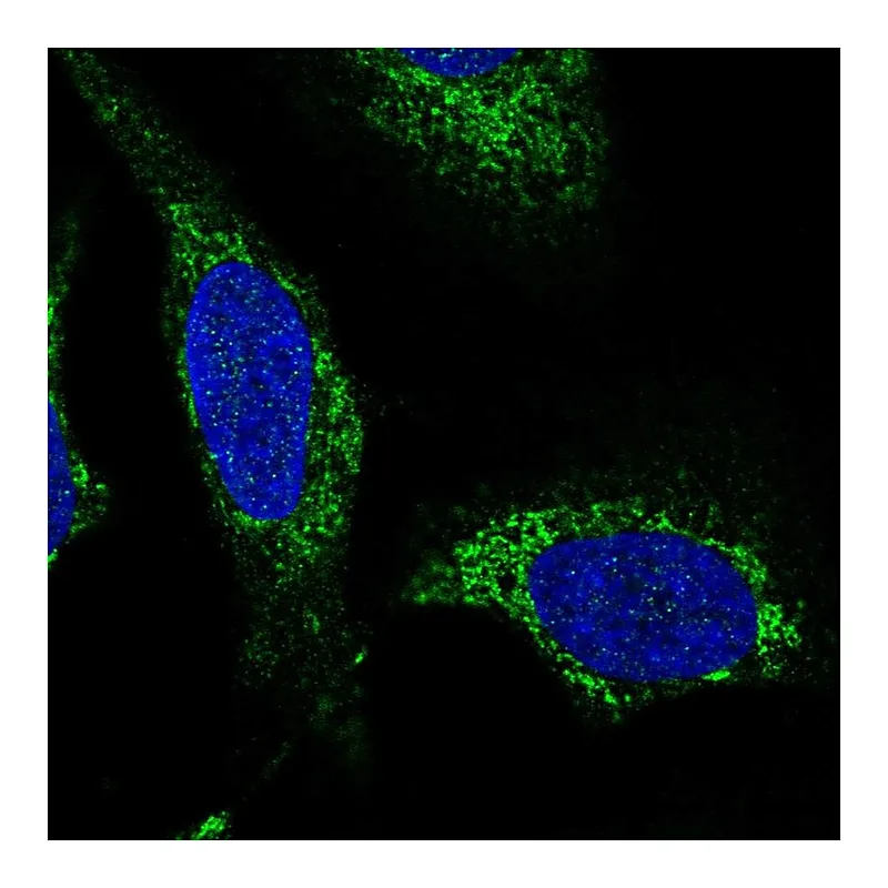 Atlas Antibodies Anti-SLC25A44 Antibody