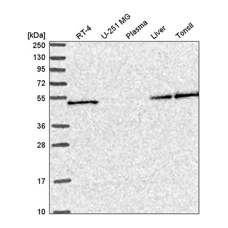 Atlas Antibodies Anti-SLC25A46 Antibody