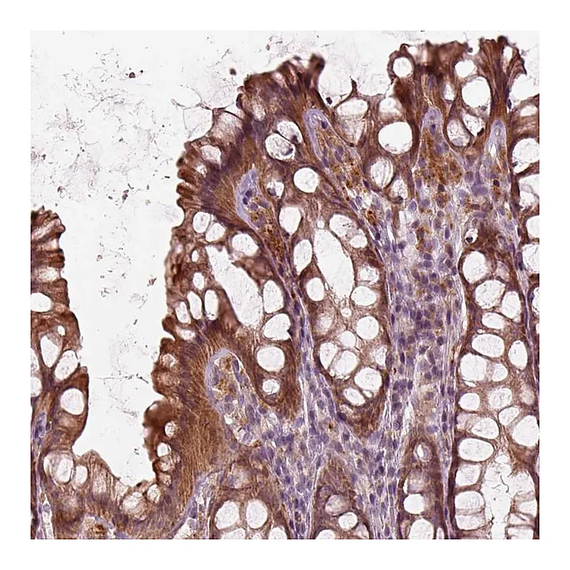 Atlas Antibodies Anti-SLC25A46 Antibody