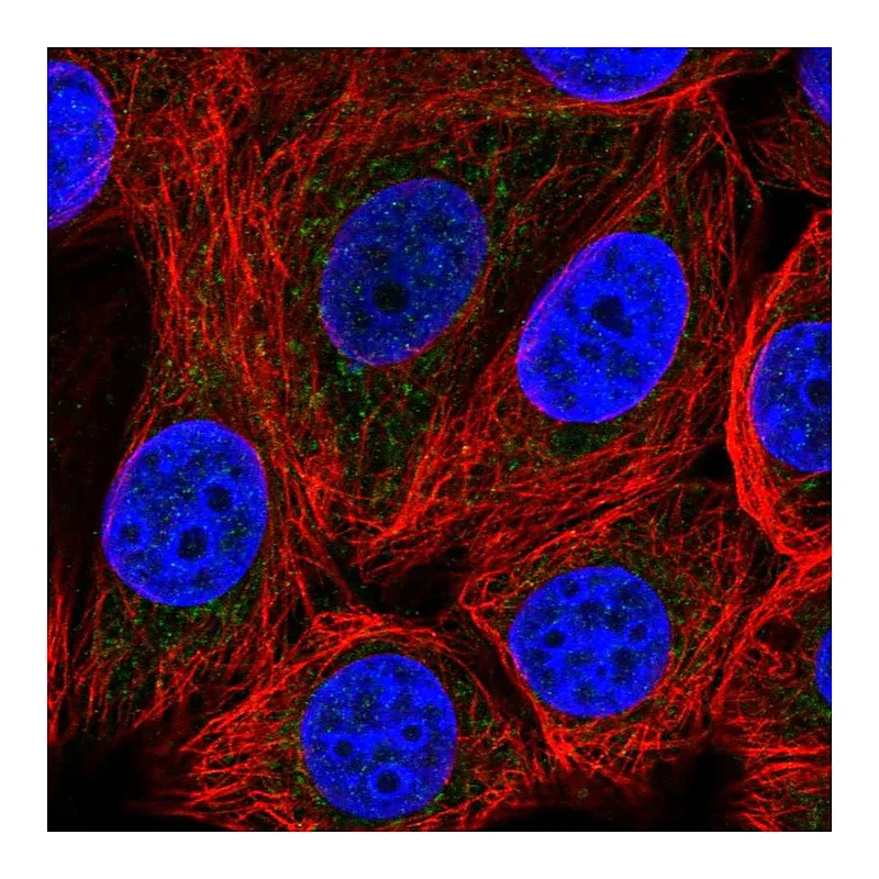 Atlas Antibodies Anti-SLC25A51 Antibody