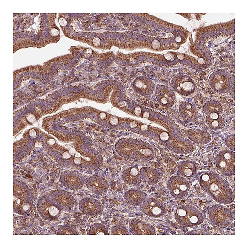Atlas Antibodies Anti-SLC25A5 Antibody