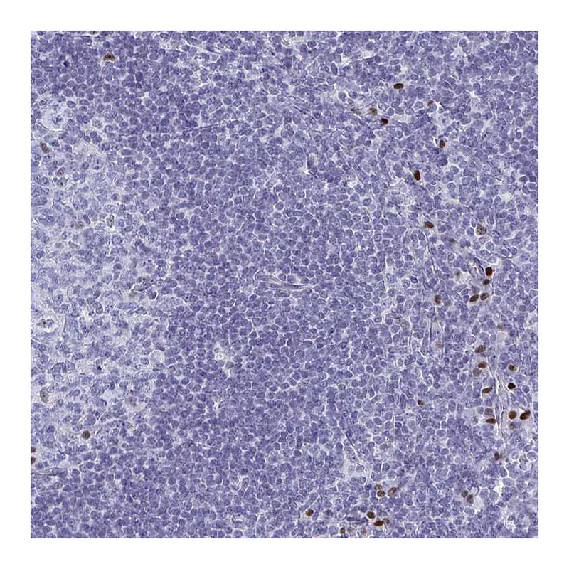 Atlas Antibodies Anti-SLC25A51 Antibody