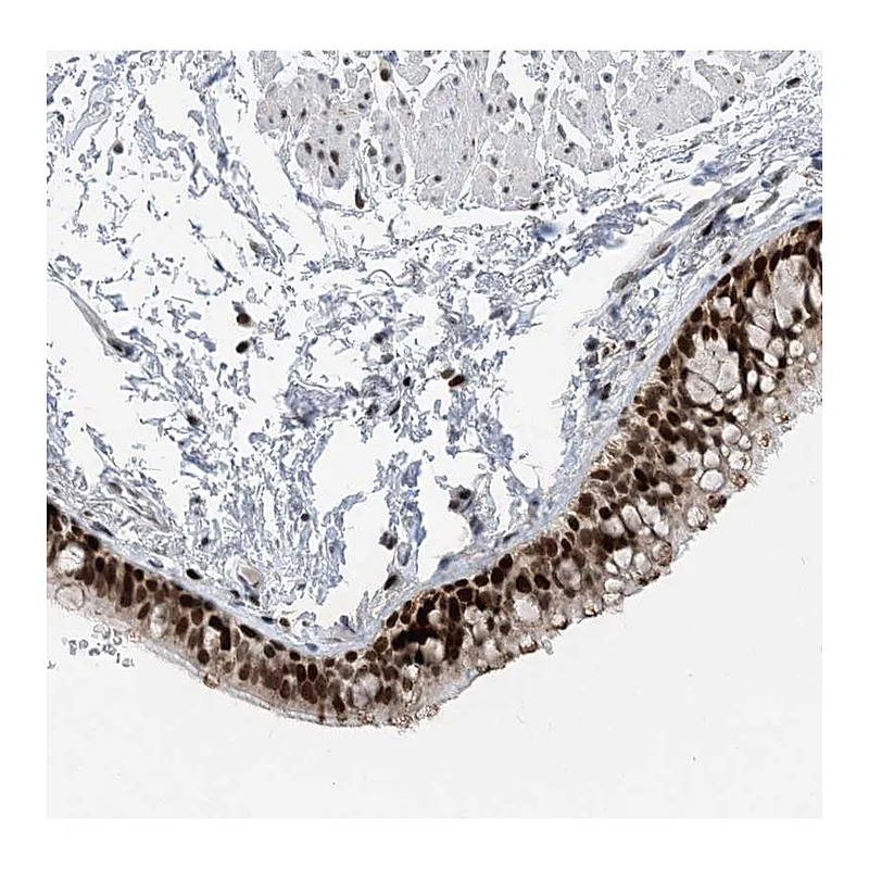 Atlas Antibodies Anti-SLC25A53 Antibody