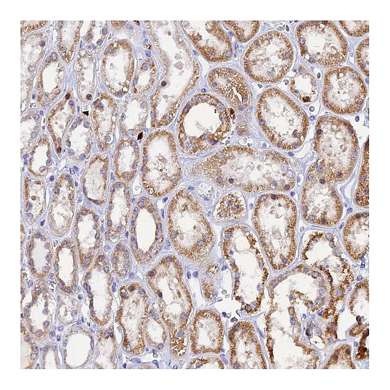 Atlas Antibodies Anti-SLC26A1 Antibody
