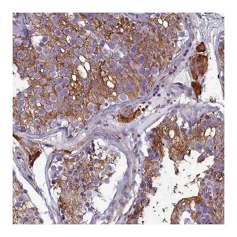 Atlas Antibodies Anti-SLC26A10 Antibody