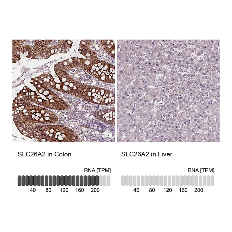 Atlas Antibodies Anti-SLC26A2 Antibody