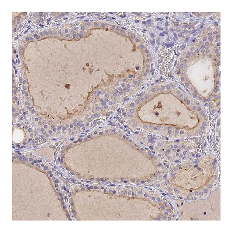 Atlas Antibodies Anti-SLC26A4 Antibody
