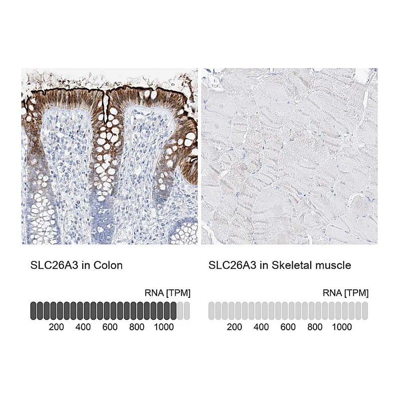 Atlas Antibodies Anti-SLC26A3 Antibody