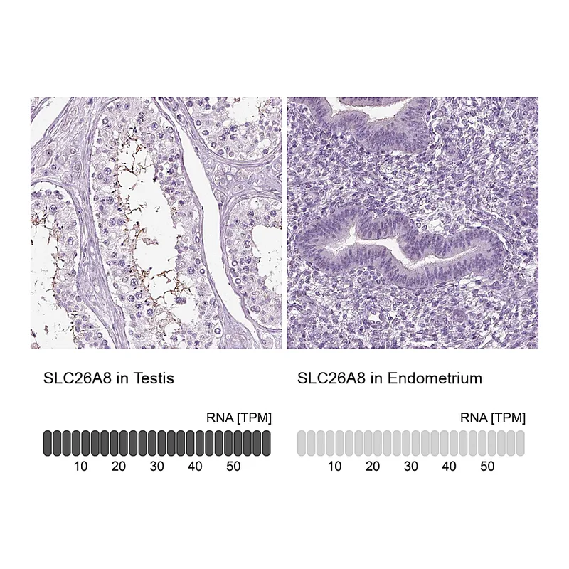 Atlas Antibodies Anti-SLC26A8 Antibody