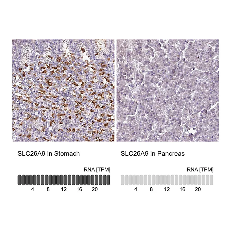 Atlas Antibodies Anti-SLC26A9 Antibody