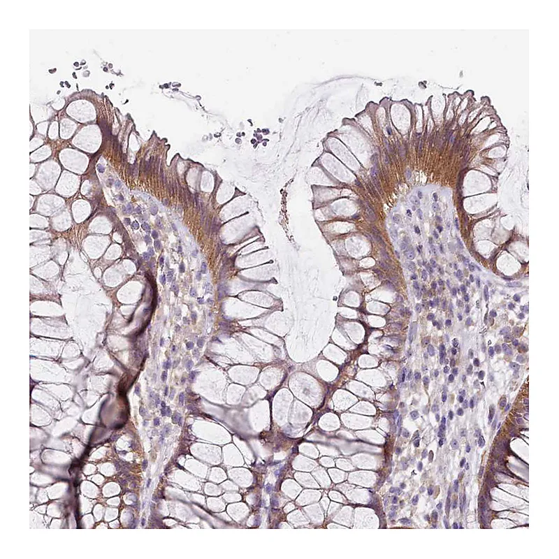 Atlas Antibodies Anti-SLC26A6 Antibody