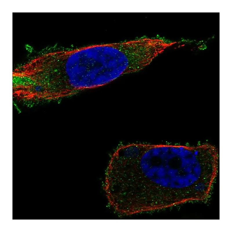 Atlas Antibodies Anti-SLC27A1 Antibody