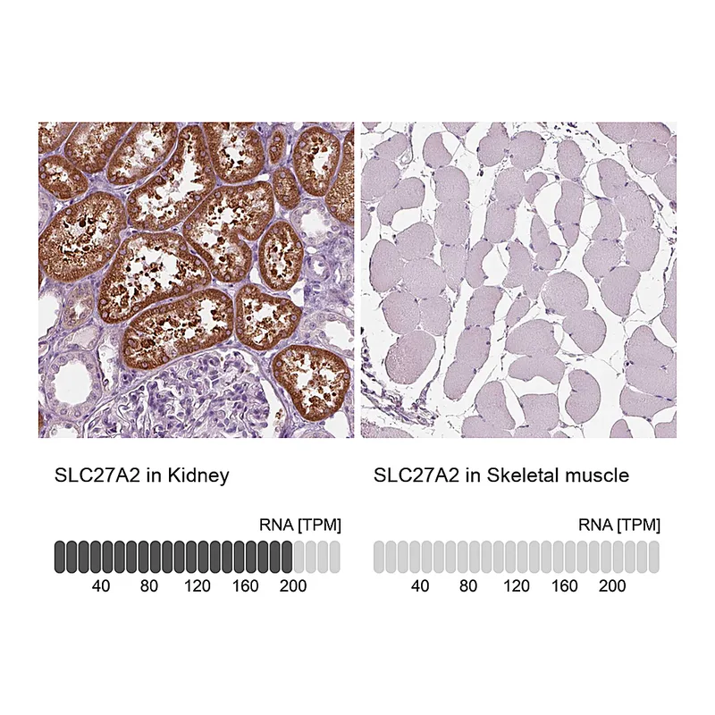 Atlas Antibodies Anti-SLC27A2 Antibody