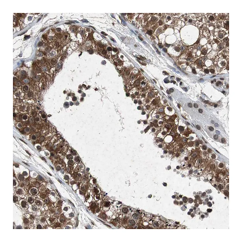 Atlas Antibodies Anti-SLC27A3 Antibody