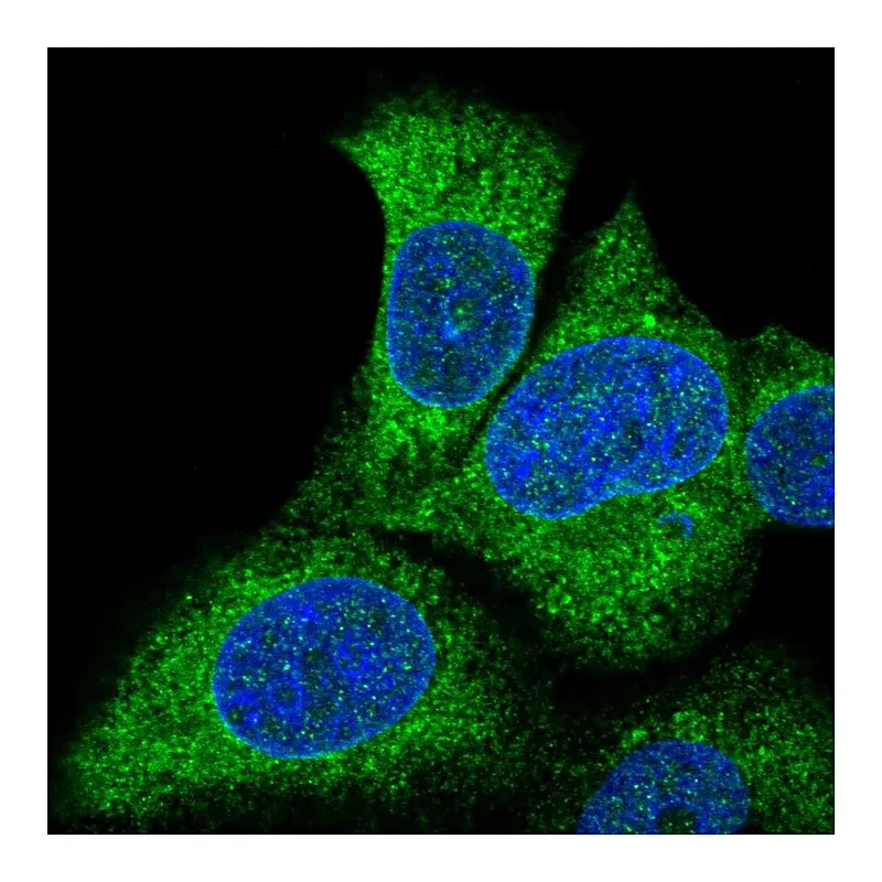 Atlas Antibodies Anti-SLC27A3 Antibody