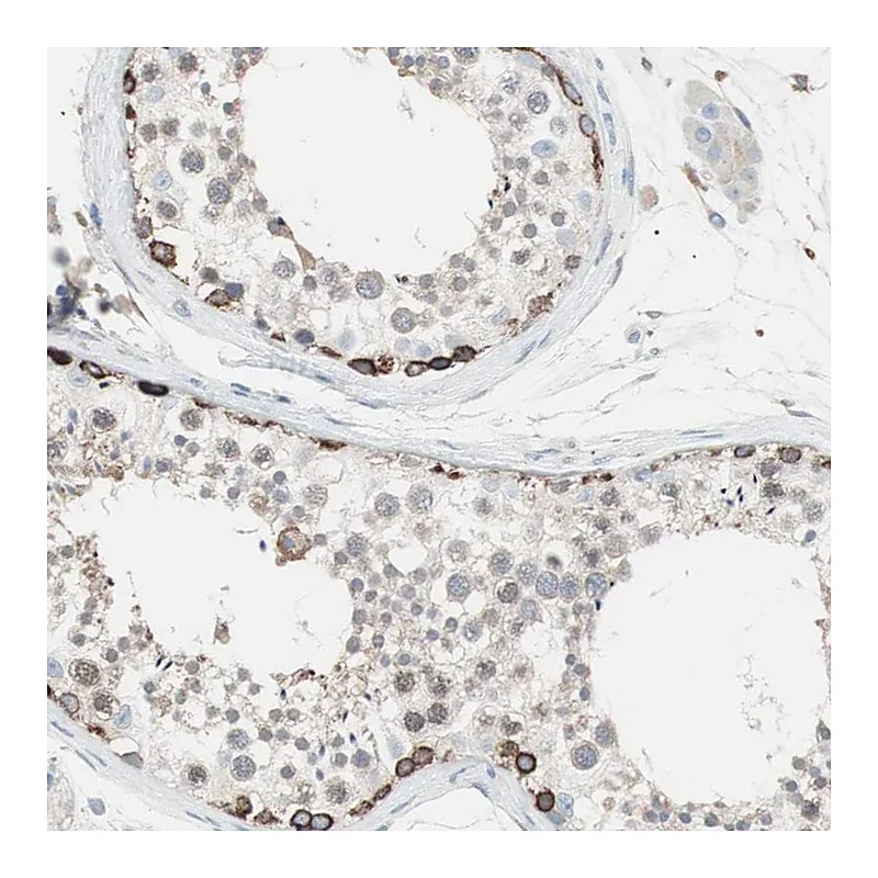 Atlas Antibodies Anti-SLC27A4 Antibody