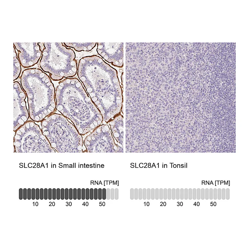 Atlas Antibodies Anti-SLC28A1 Antibody