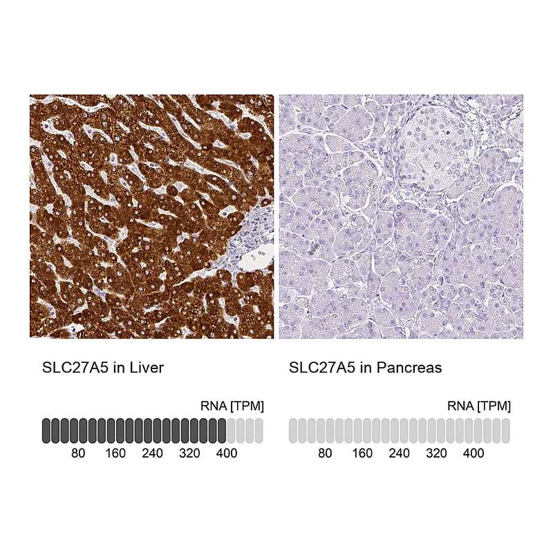 Atlas Antibodies Anti-SLC27A5 Antibody