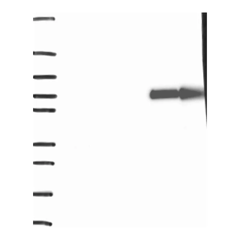 Atlas Antibodies Anti-SLC28A1 Antibody