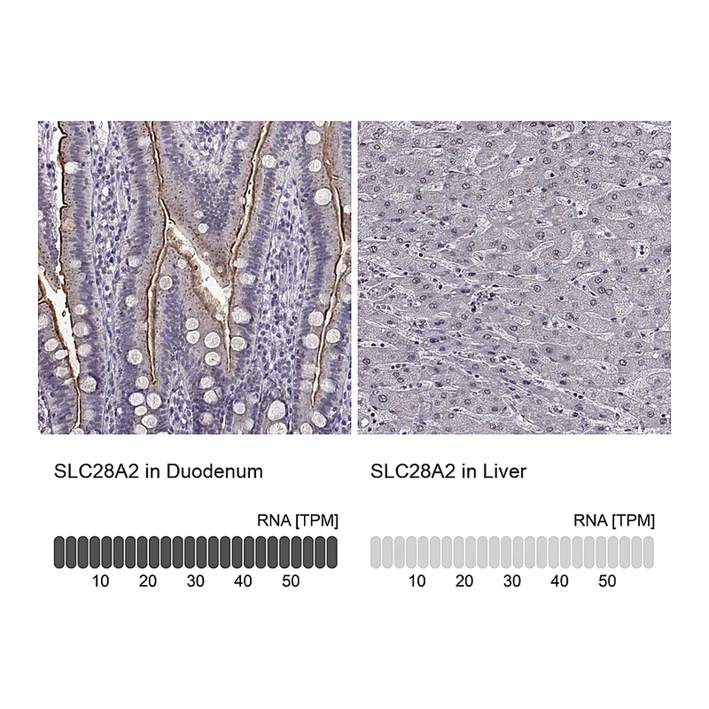 Atlas Antibodies Anti-SLC28A2 Antibody