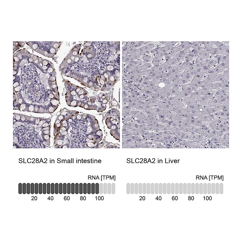 Atlas Antibodies Anti-SLC28A2 Antibody