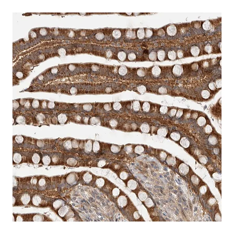 Atlas Antibodies Anti-SLC29A1 Antibody