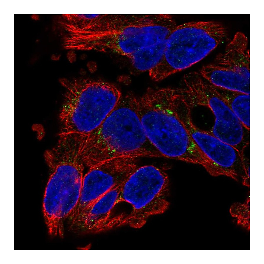 Atlas Antibodies Anti-SLC29A3 Antibody