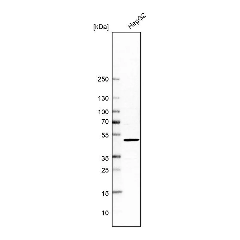Atlas Antibodies Anti-SLC29A3 Antibody