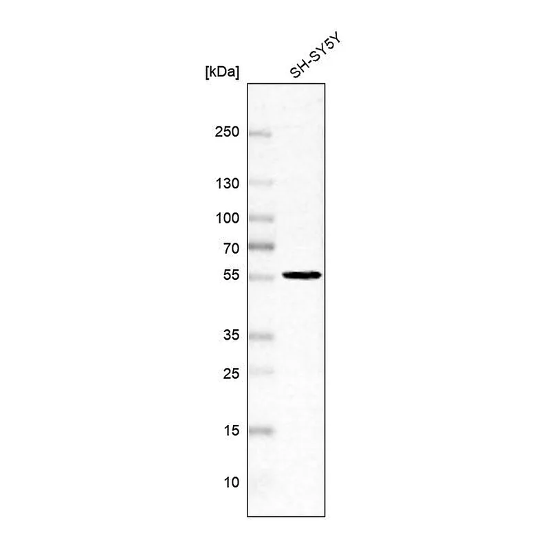 Atlas Antibodies Anti-SLC29A4 Antibody