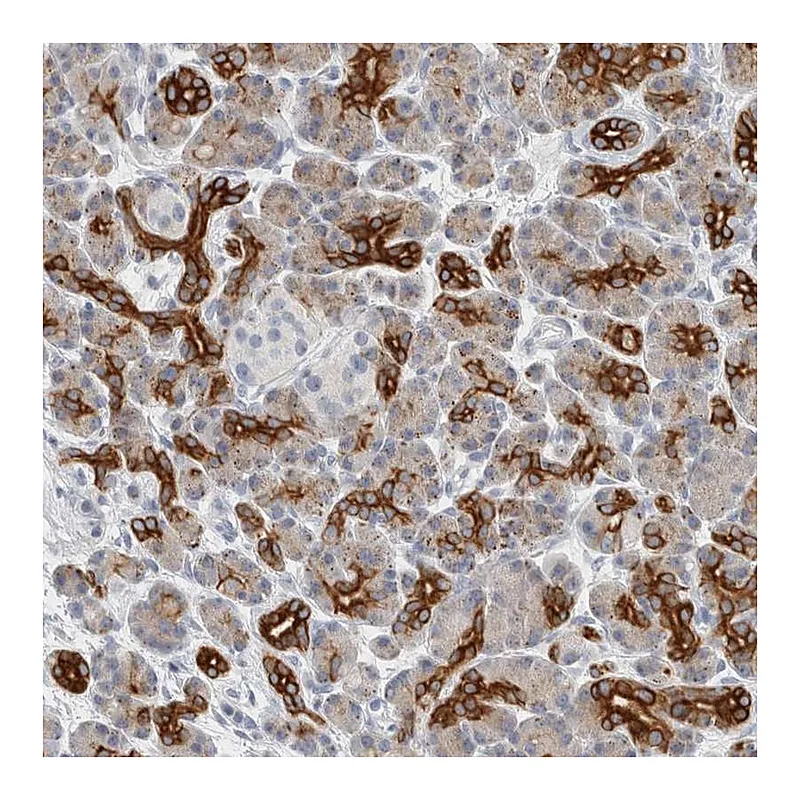 Atlas Antibodies Anti-SLC28A3 Antibody